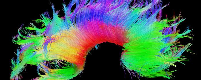 Shake the System: A Biopsychosocial Approach to Depression